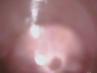 深 肛交 性别 视频 同 毛茸茸 日本语 女人