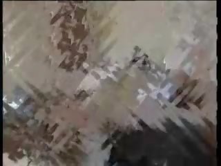 Më e mahnitshme e pacensuruar mjekësore njeri skenë ndonjëherë