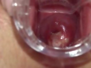 Gyno lodra në të saj e thellë vaginë kuçkë