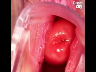 Rumaja nelia gyno md bearded clam speculum examination